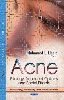 Acne : Etiology, Treatment Options and Social Effects