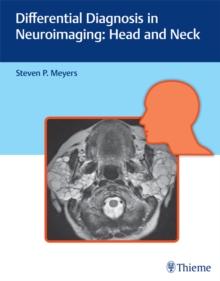 Differential Diagnosis in Neuroimaging: Head and Neck : Head and Neck