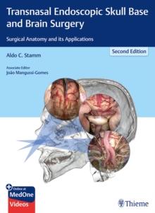 Transnasal Endoscopic Skull Base and Brain Surgery : Surgical Anatomy and its Applications