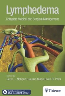 Lymphedema : Complete Medical and Surgical Management