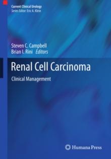 Renal Cell Carcinoma : Clinical Management