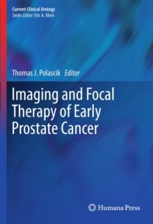 Imaging and Focal Therapy of Early Prostate Cancer