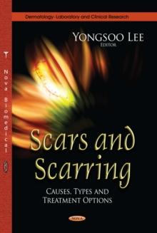 Scars and Scarring : Causes, Types and Treatment Options