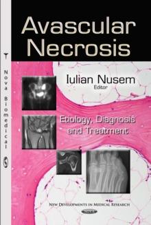 Avascular Necrosis : Etiology, Diagnosis and Treatment