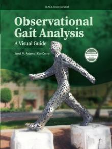 Observational Gait Analysis : A Visual Guide