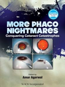 More Phacoo Nightmares : Conquering Cataract Catastrophes