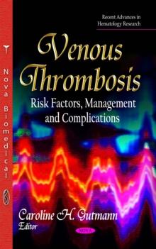 Venous Thrombosis : Risk Factors, Management and Complications