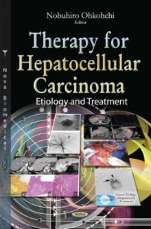 Therapy for Hepatocellular Carcinoma - Etiology and Treatment