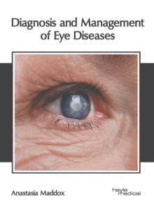 Diagnosis and Management of Eye Diseases