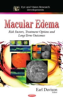 Macular Edema : Risk Factors, Treatment Options and Long-Term Outcomes