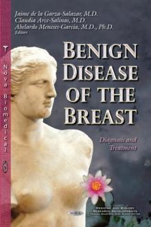 Benign Disease of the Breast : Diagnosis and Treatment