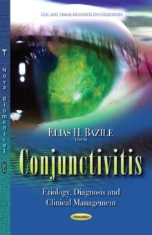 Conjunctivitis : Etiology, Diagnosis and Clinical Management