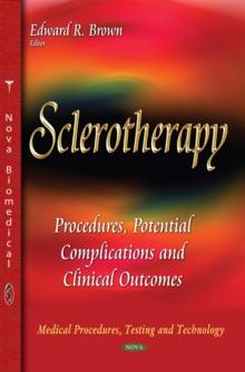 Sclerotherapy : Procedures, Potential Complications and Clinical Outcomes