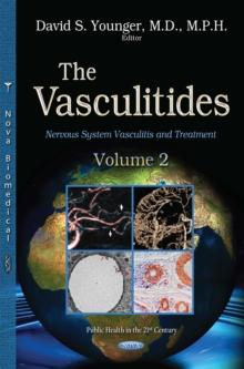 The Vasculitides, Volume 2 : Nervous System Vasculitis and Treatment