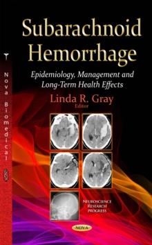 Subarachnoid Hemorrhage : Epidemiology, Management and Long-Term Health Effects