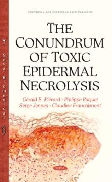 The Conundrum of Toxic Epidermal Necrolysis