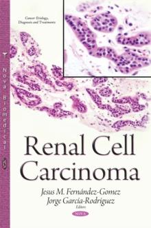 Renal Cell Carcinoma