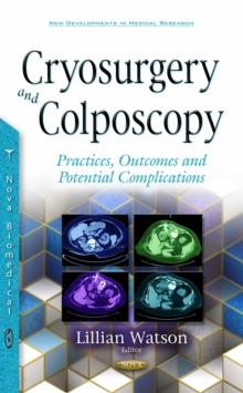 Cryosurgery and Colposcopy : Practices, Outcomes and Potential Complications