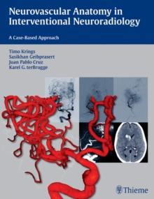 Neurovascular Anatomy in Interventional Neuroradiology : A Case-Based Approach