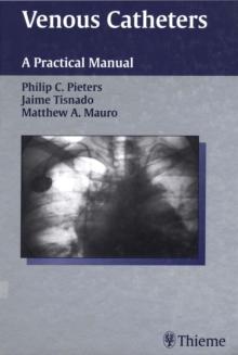 Venous Catheters : A Practical Manual