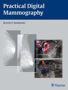 Practical Digital Mammography