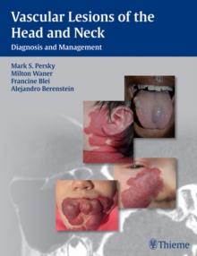 Vascular Lesions of the Head and Neck : Diagnosis and Management