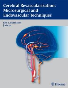 Cerebral Revascularization: Microsurgical and Endovascular Techniques