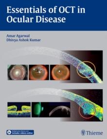 Essentials of OCT in Ocular Disease