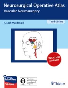 Neurosurgical Operative Atlas: Vascular Neurosurgery