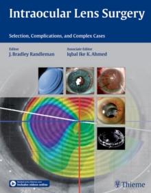 Intraocular Lens Surgery : Selection, Complications, and Complex Cases