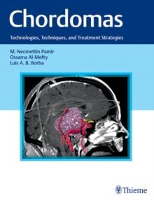 Chordomas : Technologies, Techniques, and Treatment Strategies