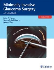 Minimally Invasive Glaucoma Surgery : A Practical Guide