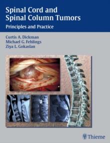 Spinal Cord and Spinal Column Tumors : Principles and Practice