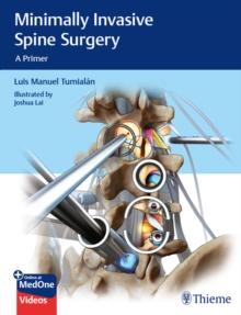 Minimally Invasive Spine Surgery : A Primer