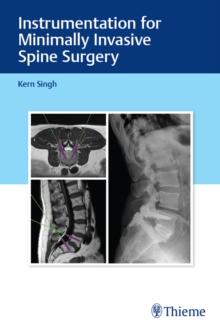 Instrumentation for Minimally Invasive Spine Surgery