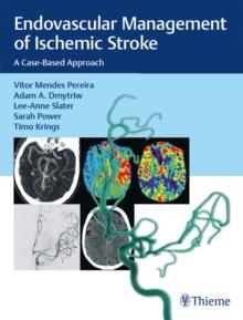 Endovascular Management of Ischemic Stroke : A Case-Based Approach