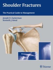 Shoulder Fractures : The Practical Guide to Management