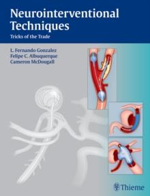 Neurointerventional Techniques : Tricks of the Trade