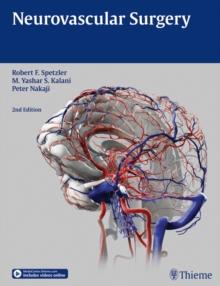 Neurovascular Surgery