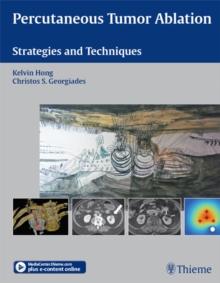 Percutaneous Tumor Ablation : Strategies and Techniques