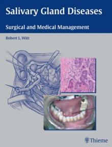 Salivary Gland Diseases : Surgical and Medical Management