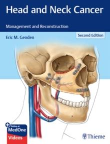 Head and Neck Cancer : Management and Reconstruction