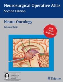 Neuro-Oncology