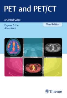 PET and PET/CT : A Clinical Guide