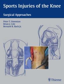 Sports Injuries of the Knee : Surgical Approaches