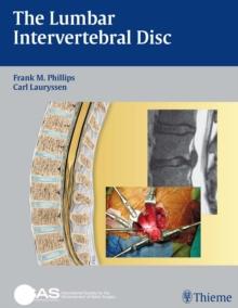 The Lumbar Intervertebral Disc