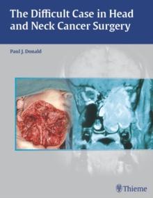 The Difficult Case in Head and Neck Cancer Surgery