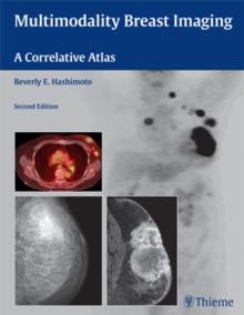 Multimodality Breast Imaging : A Correlative Atlas