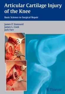 Articular Cartilage Injury of the Knee: Basic Science to Surgical Repair