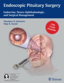 Endoscopic Pituitary Surgery : Endocrine, Neuro-Ophthalmologic, and Surgical Management